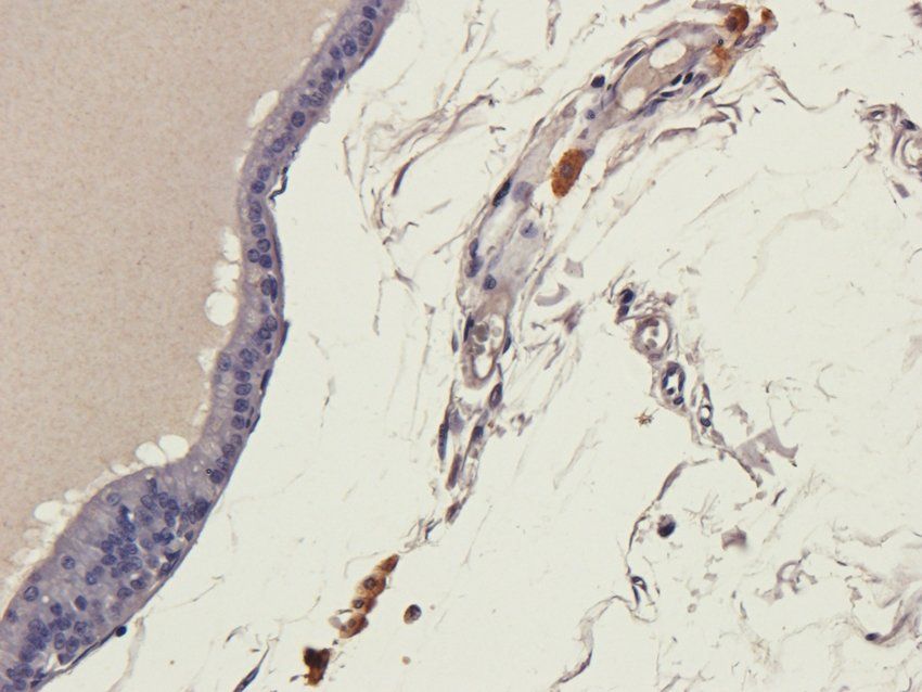 CLDN3 Rabbit Polyclonal Antibody