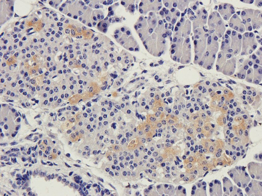 CLDN3 Rabbit Polyclonal Antibody