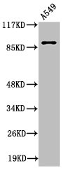 ITGAV Antibody
