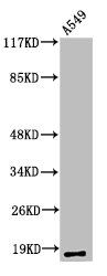 MMP1 Antibody