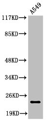 PARP1 Antibody