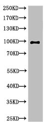 PARP1 Antibody