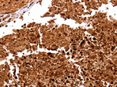 CLEC4A Antibody