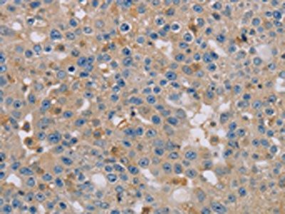 CLIC1 Antibody