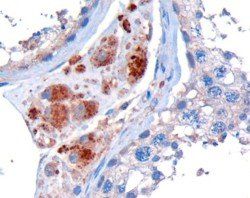 Clik1/STK35 Antibody