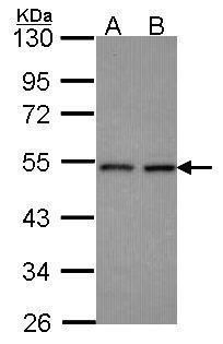 CLP1 Rabbit Polyclonal Antibody