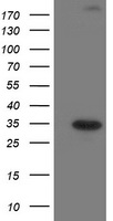 CLPP Antibody