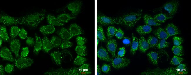 CLPP antibody [C2C3], C-term