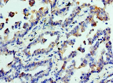 CLTA Antibody