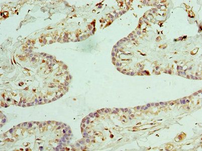 CLTA Antibody