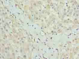 CLYBL Antibody