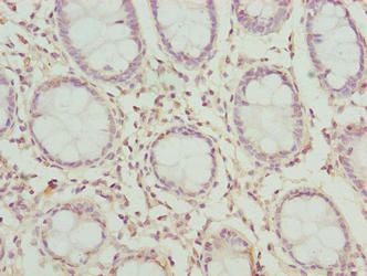 CLYBL Antibody
