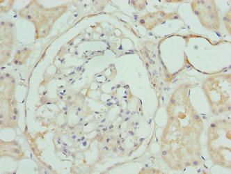 CLYBL Antibody