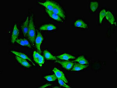 CMBL Antibody