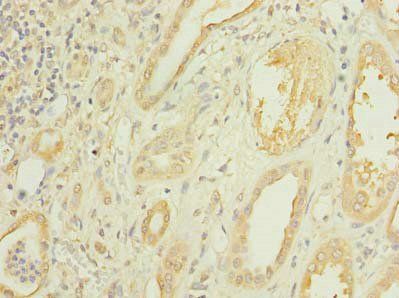 CMBL Antibody