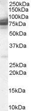 CMG1/CCDC2/IFT74 Antibody