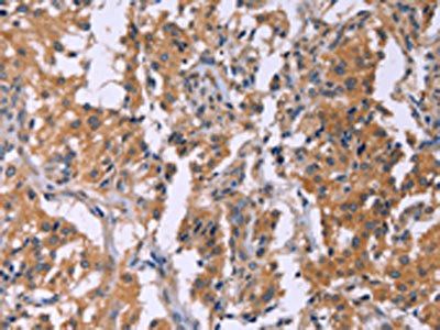 CMTM6 Antibody