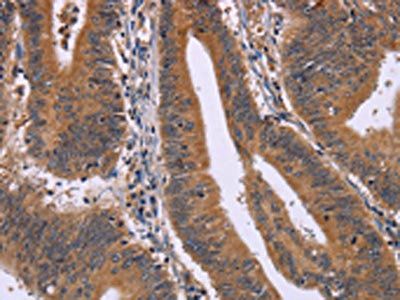 CMTM6 Antibody
