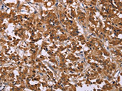 CMTM6 Antibody