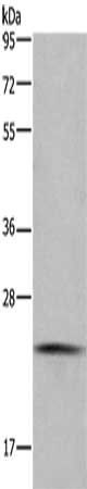 CMTM6 Antibody