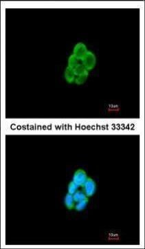 CKLF like MARVEL transmembrane domain containing 6 Antibody