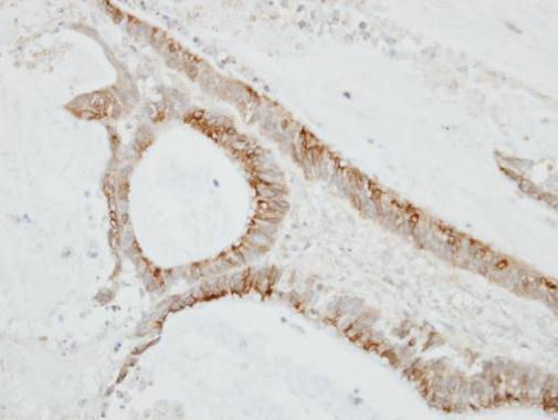 CKLF like MARVEL transmembrane domain containing 6 Antibody