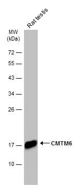 CKLF like MARVEL transmembrane domain containing 6 Antibody
