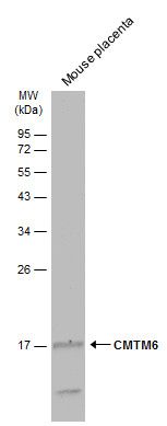 CKLF like MARVEL transmembrane domain containing 6 Antibody