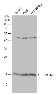 CKLF like MARVEL transmembrane domain containing 6 Antibody