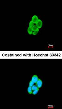 CKLF-like MARVEL transmembrane domain containing 6 antibody