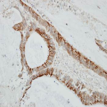CKLF-like MARVEL transmembrane domain containing 6 antibody