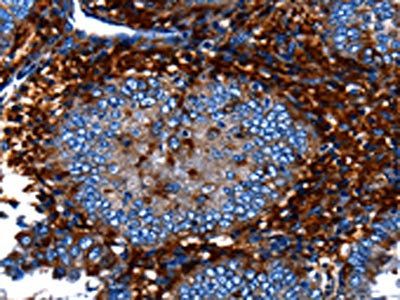 CNGA2 Antibody