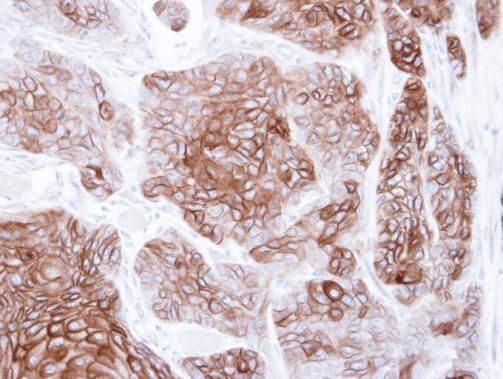 cyclic nucleotide gated channel alpha 2 Antibody