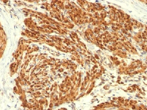 CNN1 Antibody