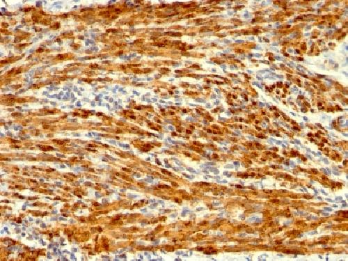 CNN1 Antibody