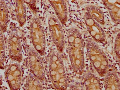 CNNM4 Antibody