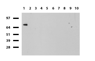 CNP Antibody