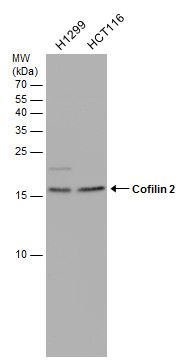 Cofilin 2 antibody