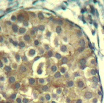 cofilin1/cofilin2 (phospho-Tyr88) Antibody