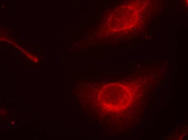 cofilin (Phospho-Ser3) Antibody