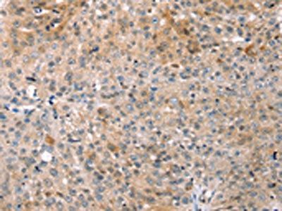 COLEC11 Antibody