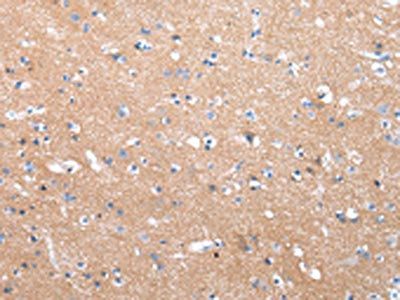COLEC12 Antibody