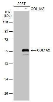 COL1A2 antibody [C2C3], C-term