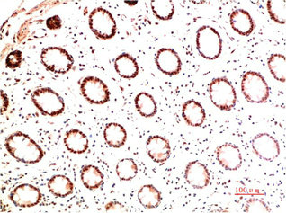COL1A1 Monoclonal Antibody