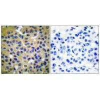 COL2A1 Antibody
