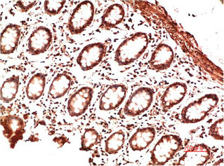 COL2A1 Monoclonal Antibody