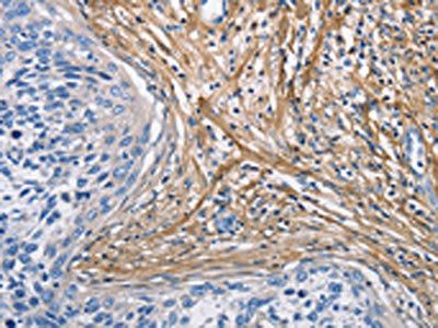 COL3A1 Antibody