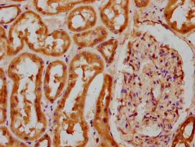 COL4A5 Antibody