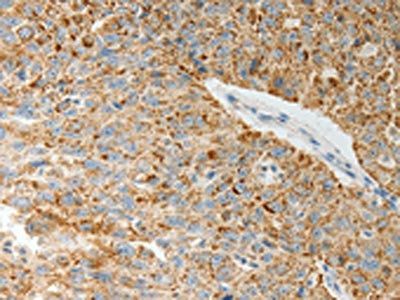 COL4A3 Antibody