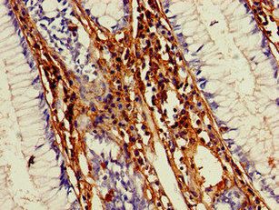MMP13 Antibody